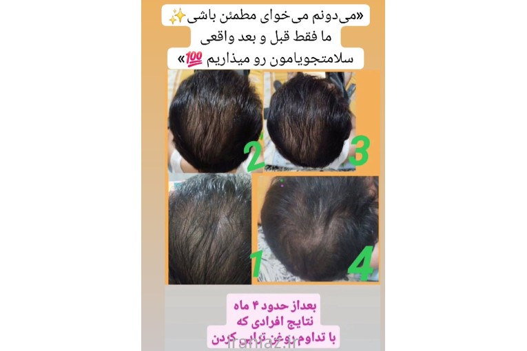 سلامت مو و زیبایی