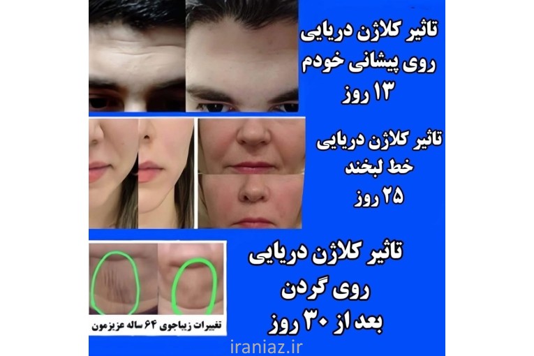 نمایندگی رسمی کلاژن هیدرولیزی اصل ایتالیایی 