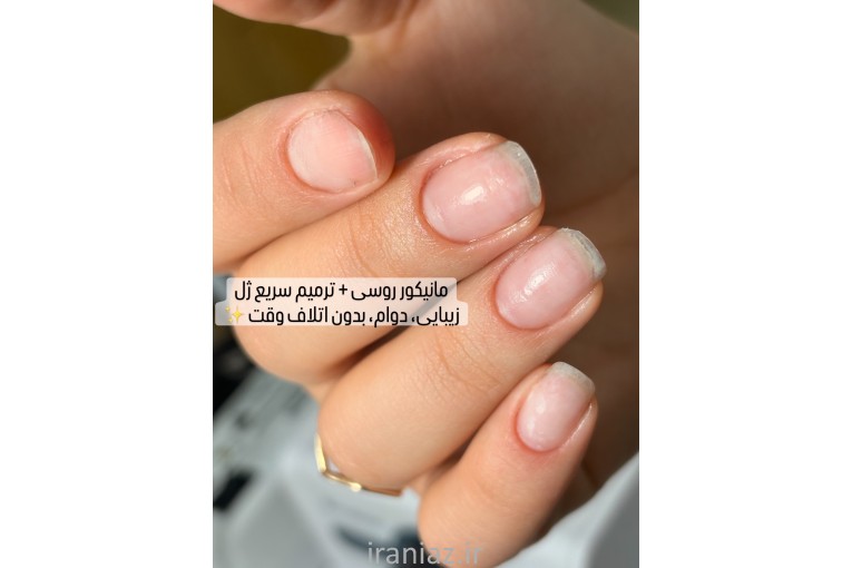 کاشت ترمیم طراحی ناخن