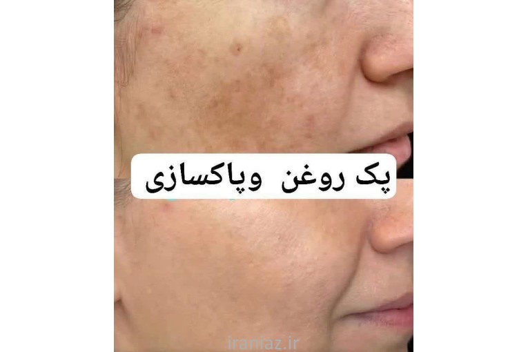 سلامتی باپاکسازی