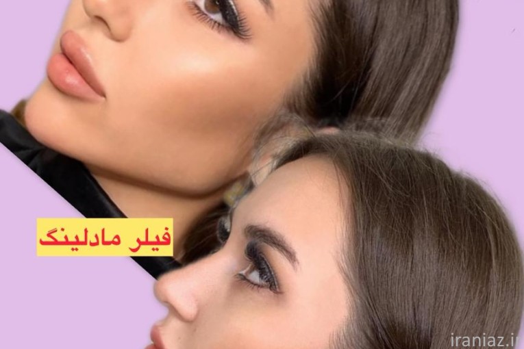 لیزر فیلر بوتاکس هایفو