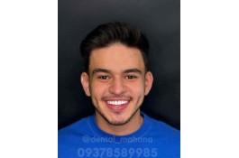 مرکز کامپوزیت دندان کرج ماهانا