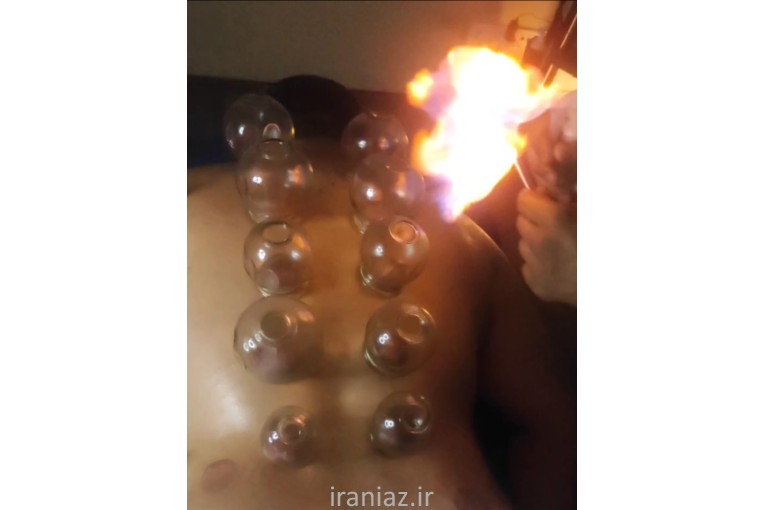 ماساژ در مرزداران