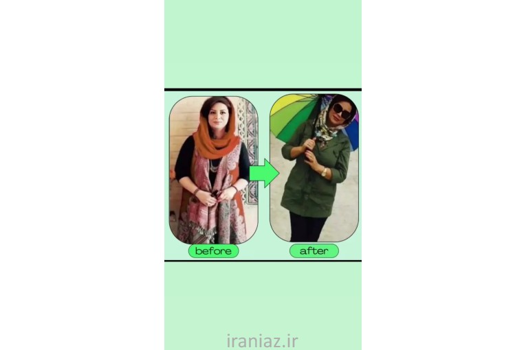 درمان لاغری بدون رژیم و ورزش و عوارض