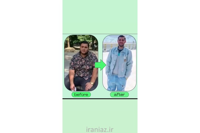 درمان لاغری بدون رژیم و ورزش و عوارض