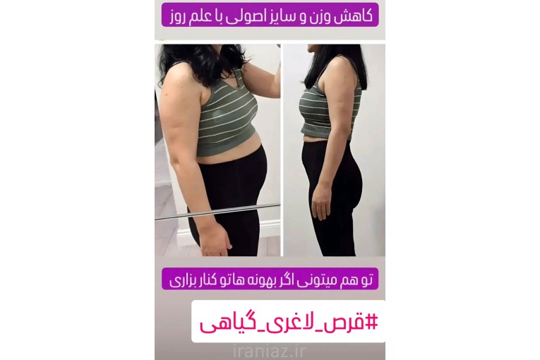 درمان لاغری بدون رژیم و ورزش و عوارض