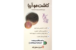 کاشت موی طبیعی با تراکم بالا در شیراز