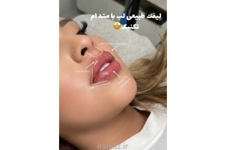 انجام خدمات زیبایی