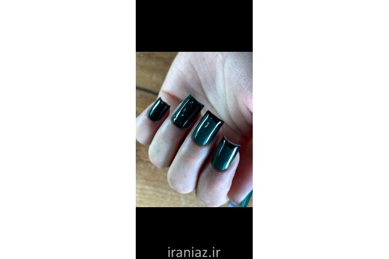 کاشت ناخن در شیروان