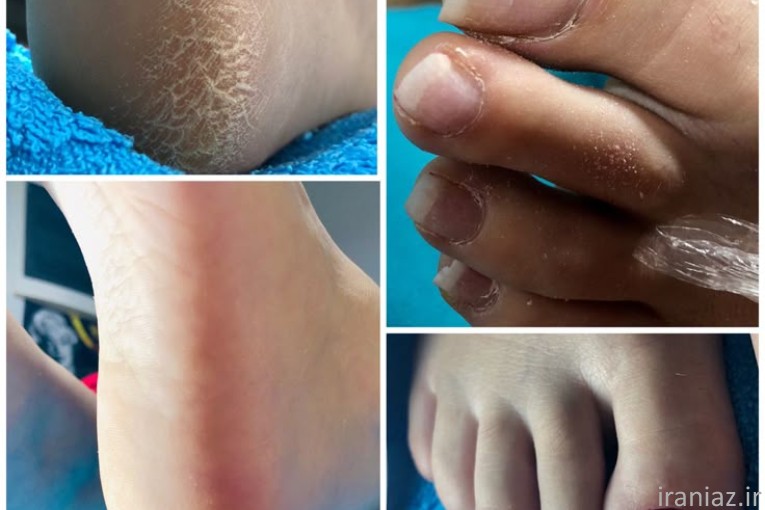 خدمات پدیکور حرفه ای درمانی و زیبایی 