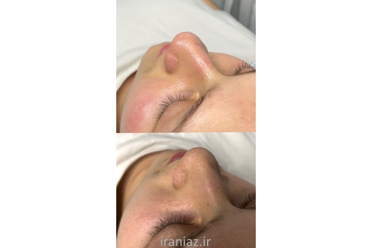 خدمات تخصصی فیشال و رسیدگی به پوست