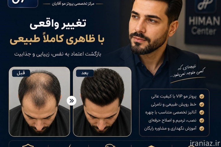 بهترین مرکز پروتز مو اصفهان | بازگشت طبیعی مو و اعتمادبه‌نفس