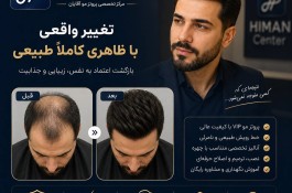 بهترین مرکز پروتز مو اصفهان | بازگشت طبیعی مو و اعتمادبه‌نفس