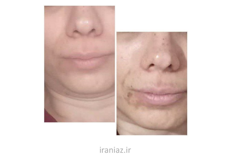 روتین پوستی 