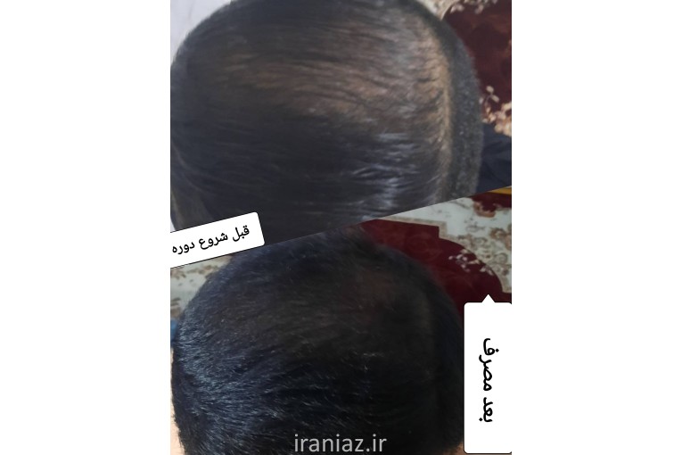 روتین پوستی 