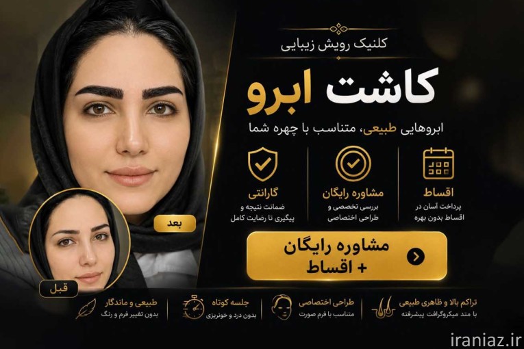 کاشت ابرو دخترونه میکروکاشت