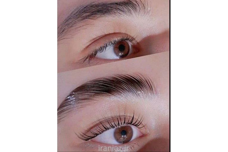 با 300 ت چهره ت رو شاداب تر و سرحال تر کن