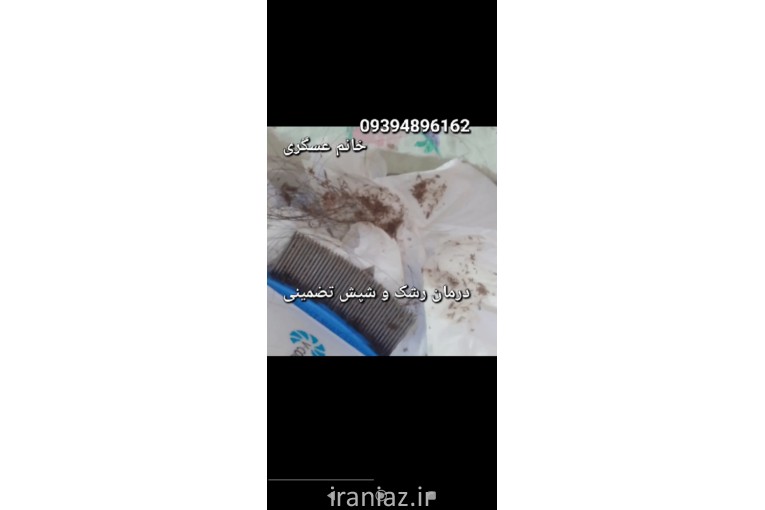 پاکسازی شپش سر