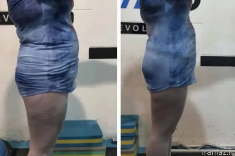 مرکز تخصصی ورزش با دستگاه EMS