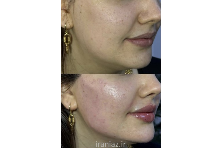 پوست مو زیبایی
