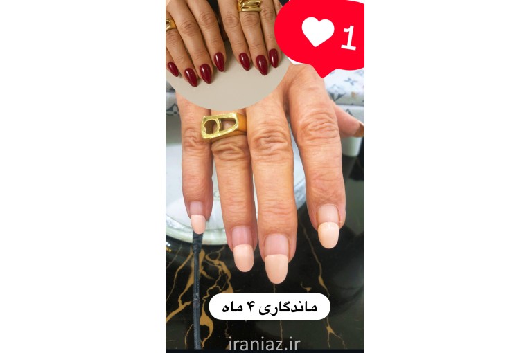 تمامی خدمات کاشت ناخن