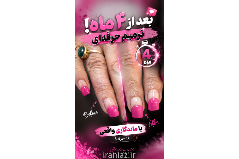 تمامی خدمات کاشت ناخن