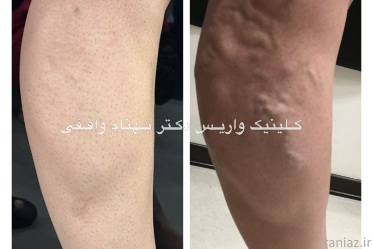 کلینیک فوق تخصصی درمان واریس دکتر واقفی
