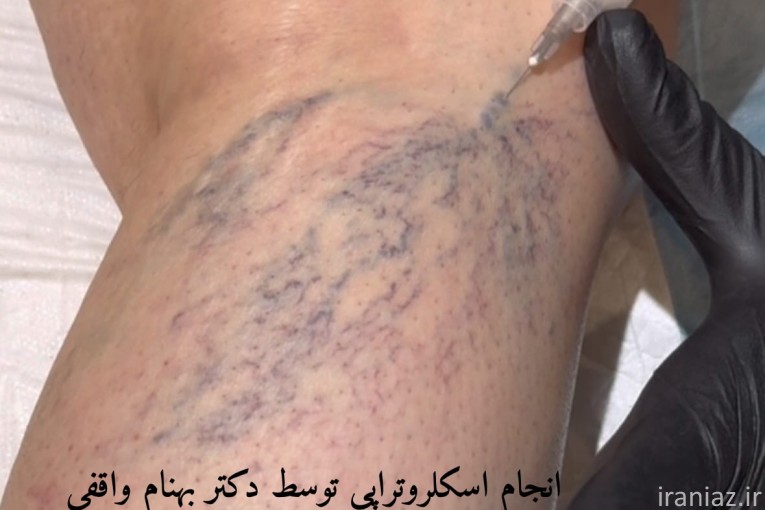 کلینیک فوق تخصصی درمان واریس دکتر واقفی