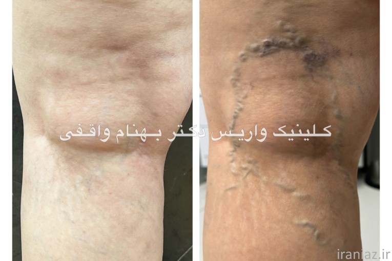 کلینیک فوق تخصصی درمان واریس دکتر واقفی