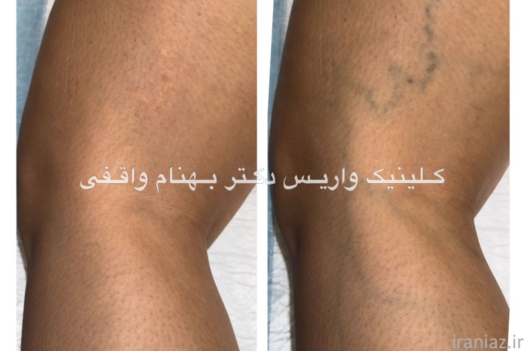 کلینیک فوق تخصصی درمان واریس دکتر واقفی