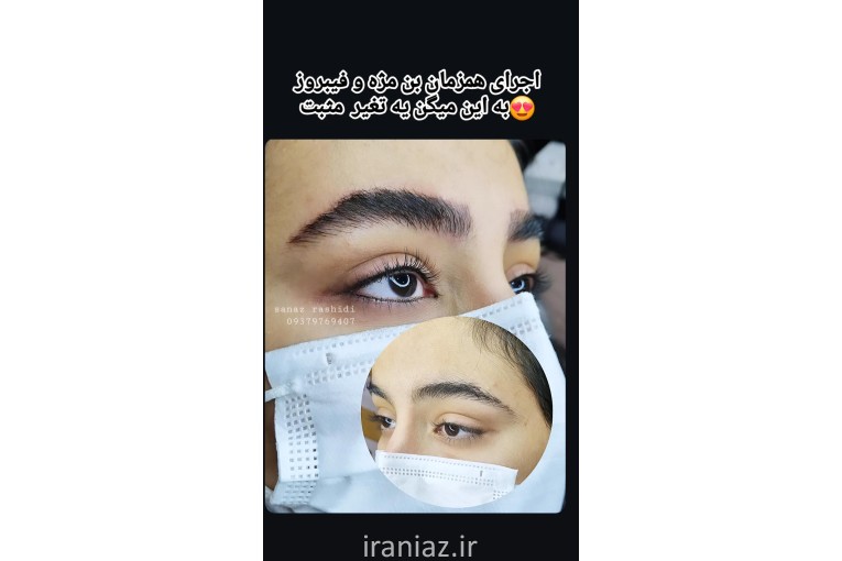 فیبروز و ریمو تخصصی تتوی صورت