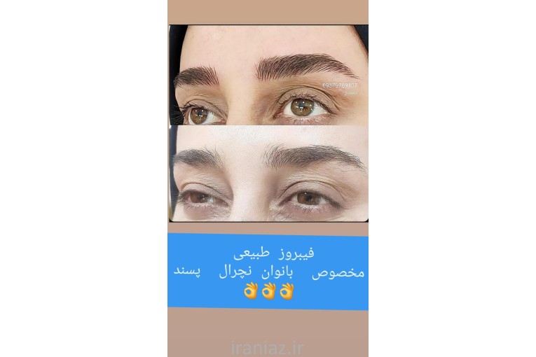 فیبروز و ریمو تخصصی تتوی صورت