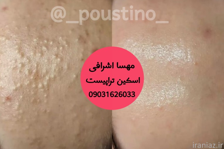 فشیال تخصصی پوست
