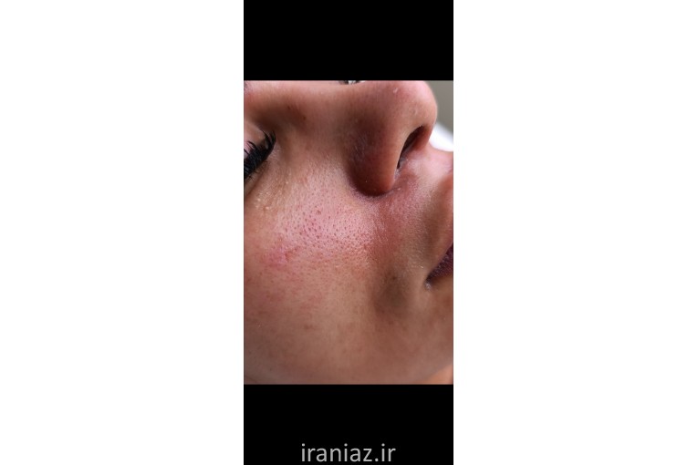فشیال تخصصی پوست