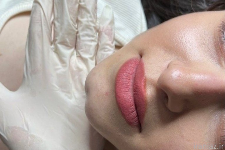 خدمات زیبایی تزریق ژل و بوتاکس