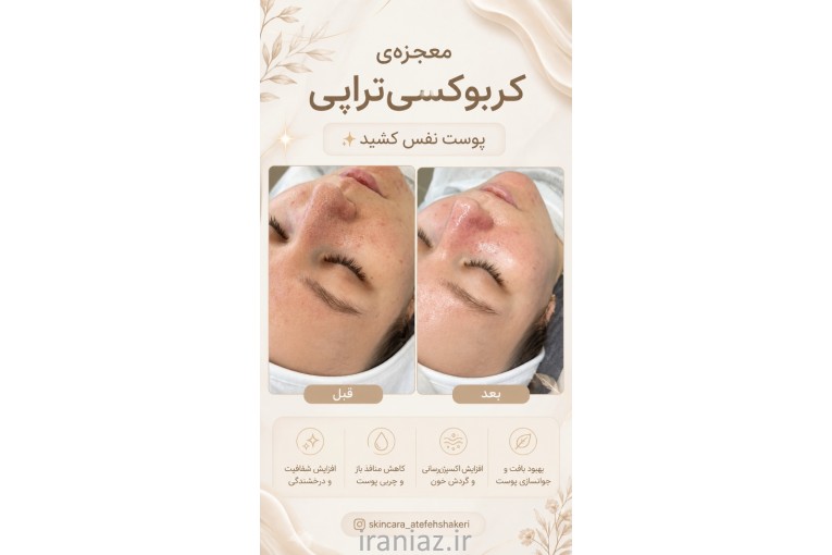 مرکز میکروبلیدینگ ابرو و پاکسازی پوست