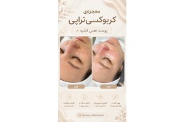 مرکز میکروبلیدینگ ابرو و پاکسازی پوست