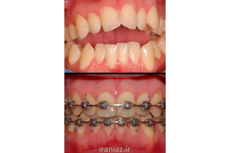 ارتودنسی اقساطی؛ لبخند زیبا را با ما تجربه کنید