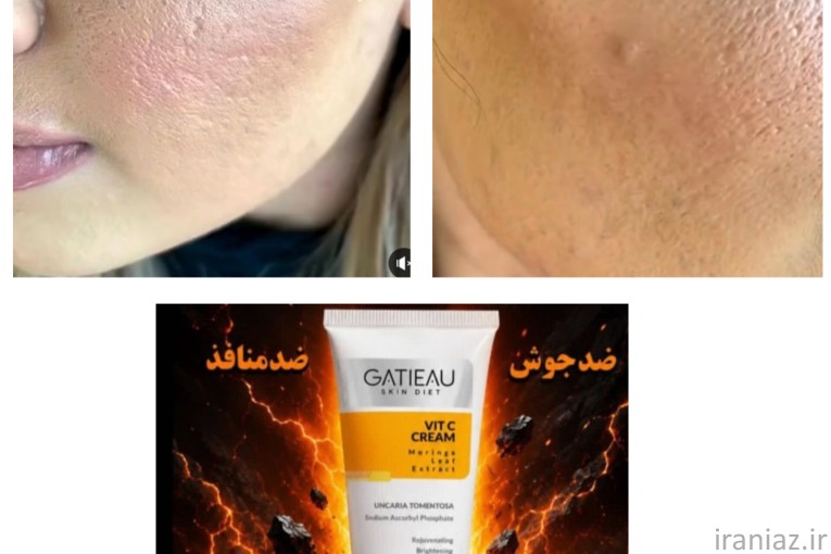 شامپو مورینگا