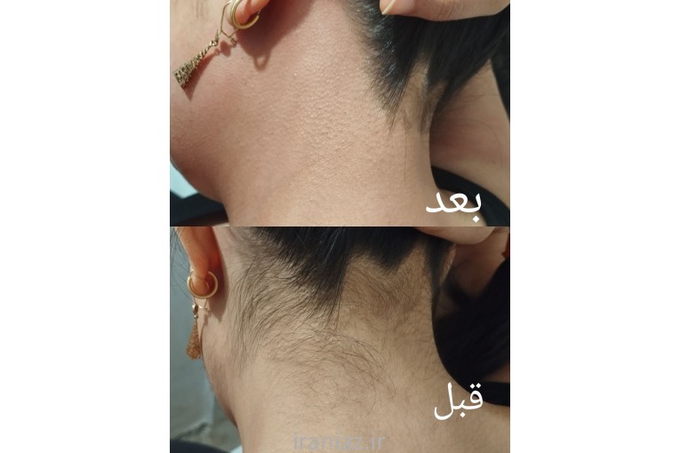 اپیلاسیون تخصصی +آموزش خصوصی