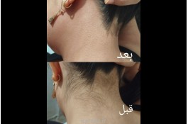 اپیلاسیون تخصصی +آموزش خصوصی