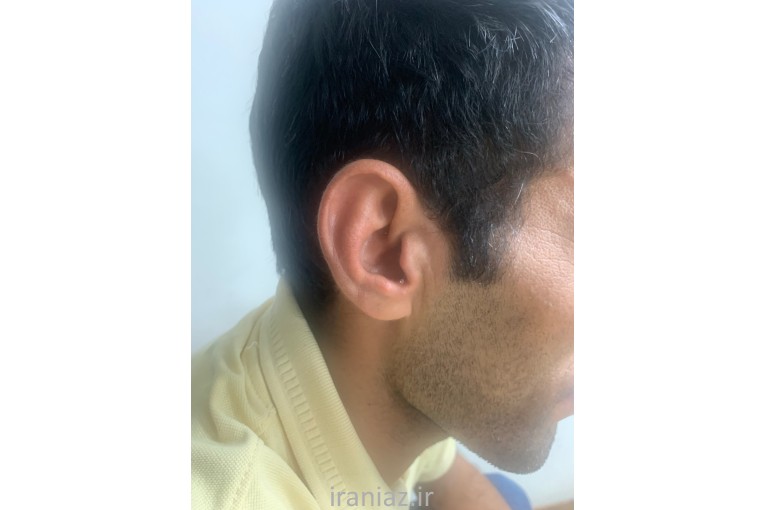 سمعک پارس - نمایندگی خرید سمعک فوناک در کرج