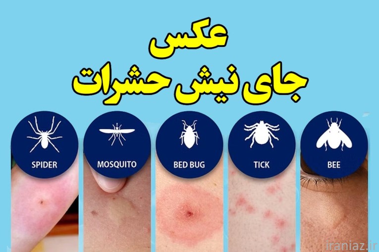 سم پاشی ساس در تهران