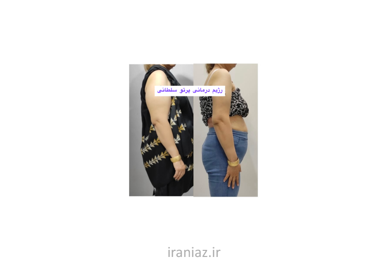 مشاور تغذیه و رژیم درمانی