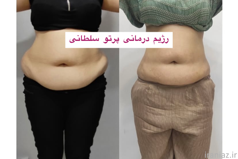 مشاور تغذیه و رژیم درمانی