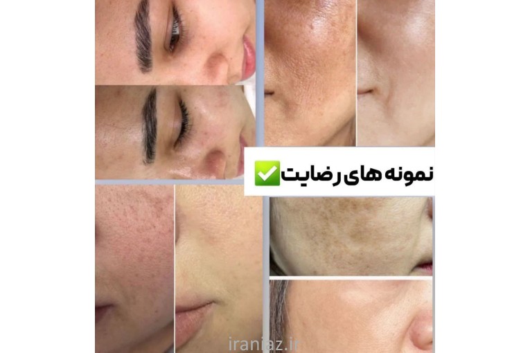 کرم بیوممتیک ویتامین سی ۸کاره