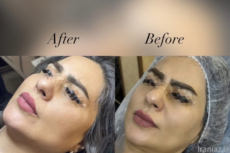 جشنواره تخفیف مطب زیبایی
