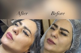 جشنواره تخفیف مطب زیبایی