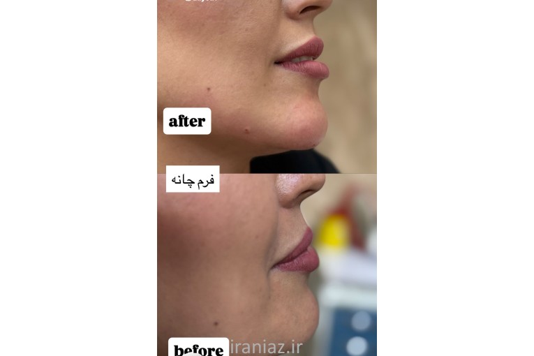 جشنواره تخفیف مطب زیبایی