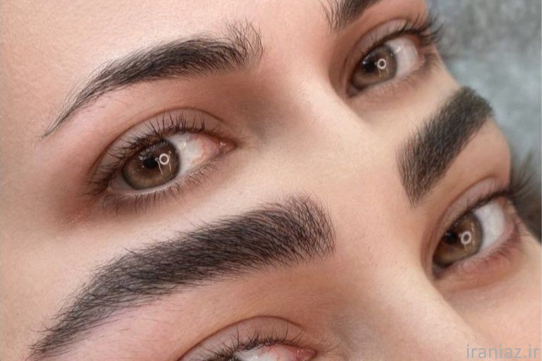 فیبروز ابرو